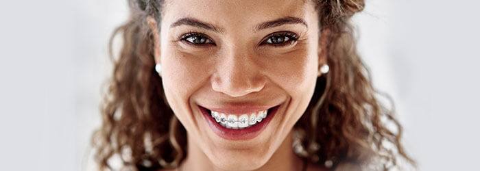 Other Tips & Tricks for Living with Braces