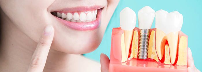 How to Prevent Tooth Loss