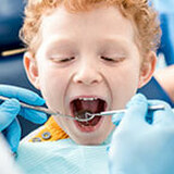 When Should Your Child Start Going to the Dentist?