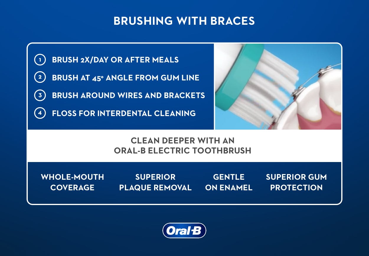 How to Brush Your Teeth and Floss With Braces