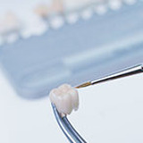 Dental Crowns: How Teeth Crowns Work