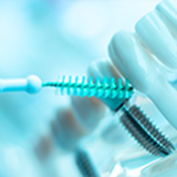 How to Clean Your Dental Implants